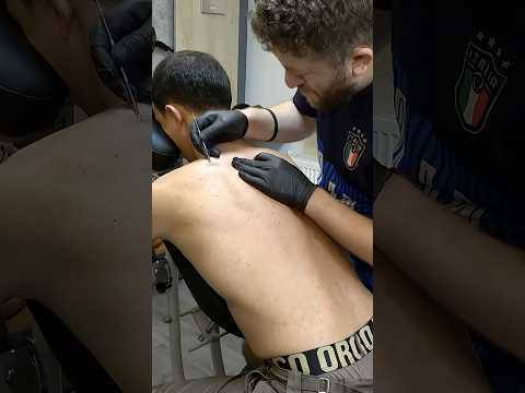 💈 DEEP BACK ACNE REMOVAL & FULL BODY MASSAGE #deepsleep #shorts #acneremoval #barberbodymassage