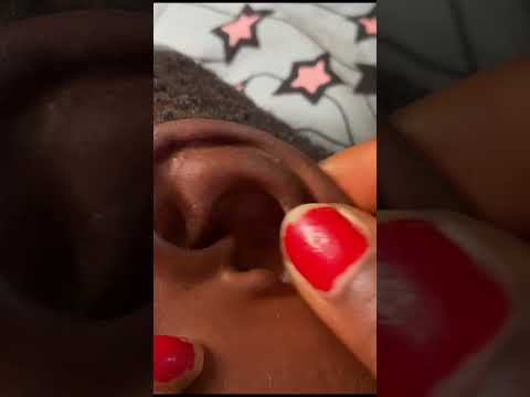 ASMR BEST SLEEP TRIGGER SO TINGLING #asmr #asmrvideos #satisfying