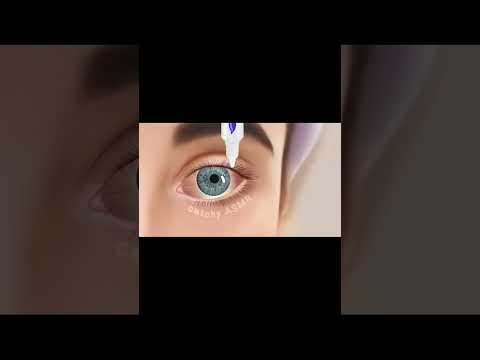 red eye treatment ASMR|| eye drop animation ASMR|| #skintreatment #animation #asmrsounds #esthetic