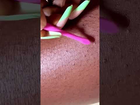 Asmr leg Nitpicking #tinglyfeeling #asmr #satisfying
