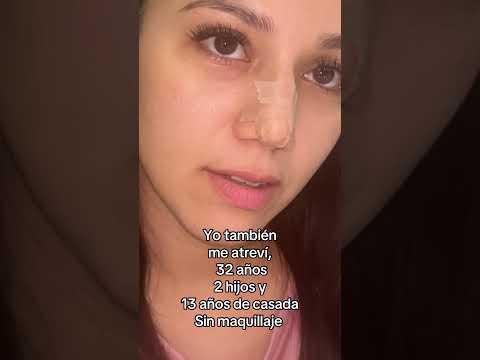 Viral