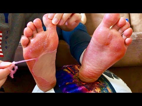 ASMR A Foot Peel Off Mask: Does it Work?! *BINAURAL TINGLES + WHISPERS*