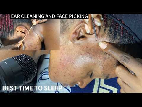 Deep Ear Cleaning, Back Scratching, Scalp Massage Ultimate Gum Chewing Whispered ASMR Sleep Triggers