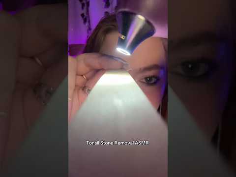 Removing your tonsil stones ASMR roleplay