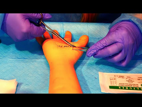 ASMR Hospital Emergency Room Sutures | Medical Role Play