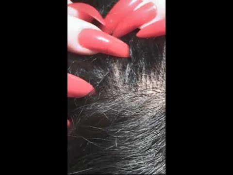 ASMR Tingly Scalp Check #Shorts