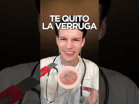 TE QUITO LA VERRUGA #asmr #shorts #asmrsounds #comedia