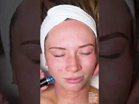 yes i know it's useless... but I love this ice dermaplaning, just so cool! #asmrfacial #asmrspa