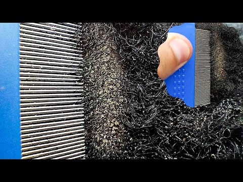 ASMR | Allzoomed Rare Super ATTENTIVE Scalp Scratching Triggers For Sleep 😴 | no talking