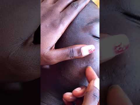 Best tingling Asmr #satisfying #asmrscratching #asmr #headscratches