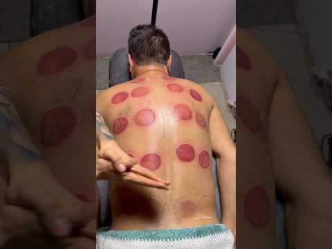 cupping pizza😍#cupping #cuppingtherapy #asmr #pizza #shorts #fire #youtubeshorts