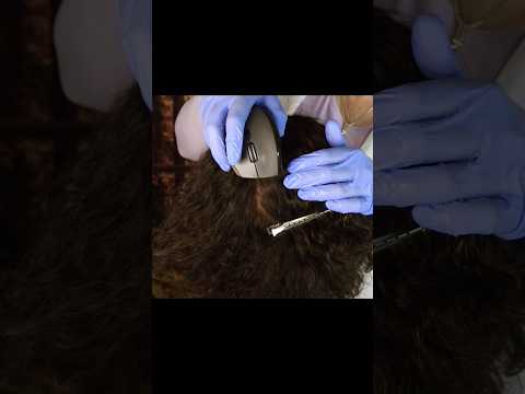 Scalp Scan with Satisfying Click Sounds