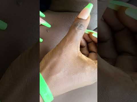 ASMR FOR PEOPLE WHO CAN’T SLEEP #relax #asmr #tingling #nitpicking #backmassager