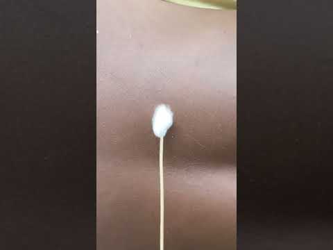 ASMR FOR PEOPLE WHO Can’t sleep #asmr #tingling #nitpicking #blackheads