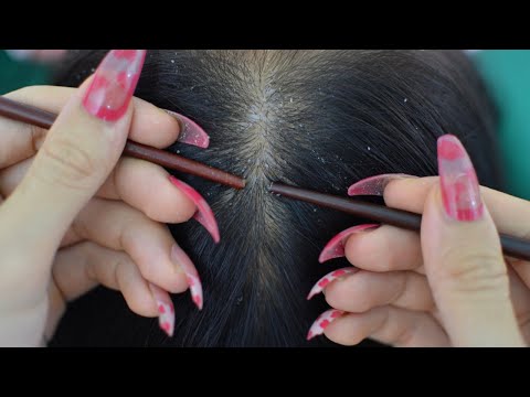 ASMR Relaxing Scalp Check With Chopsticks #longnails #scratching #dandruff #tingles