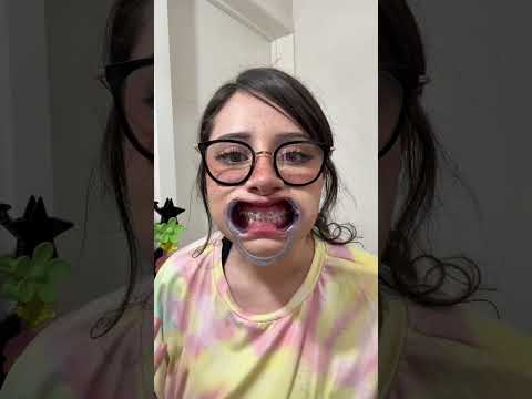 Jajajaja me daba mucha risa verme #asmr #brackets #dentista #humor
