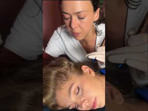 Asmr scalp tingles #asmr #asmrsounds #asmrvideo #relax #relaxing #satisfying #hair #sleep #tingles