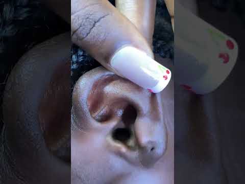 ASMR SATISFYING EAR CLEANING #asmr #satisfying #tingling #relax #asmrvideos