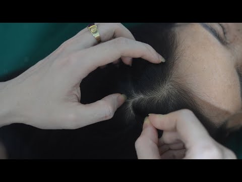 Real Person ASMR Scalp Scratch, Tingly Hair Scratching, Hair Parting For Anxiety Relief