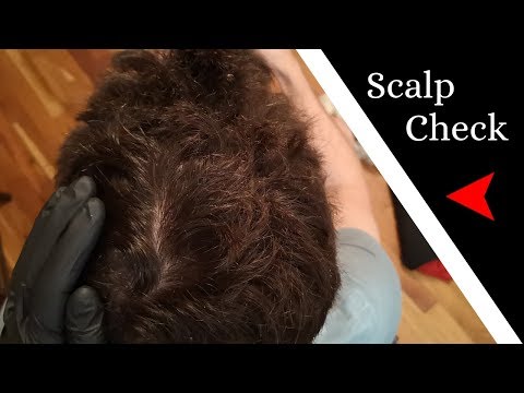 ASMR Real Person Scalp Inspection and Lice Check #5