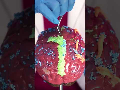 Brain operation ASMR #shorts #asmr