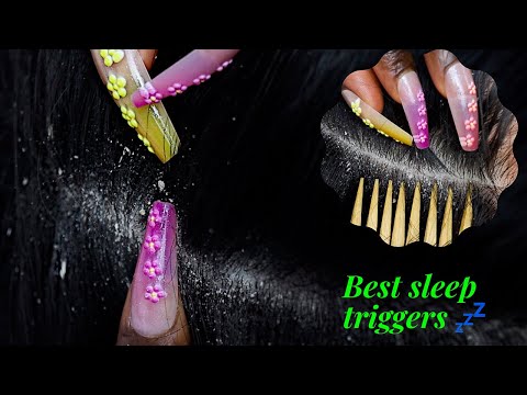 ASMR | 1HR Of The Best Super Zoomed TRIGGERS for Goodnight Sleep | scratching huge flakes | silent