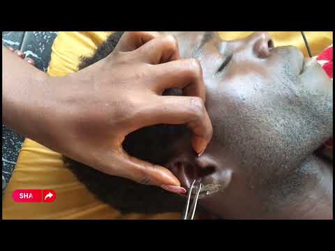 Super Attentive Ear Cleaning For Those Who Want To Sleep #nitpicking #satisfying
