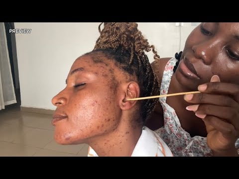 ASMR EAR CLEANING, EAR EATING, EAR LICKING, SCALP SCRATCHING, EAR BITING ASMR FOR SLEEP