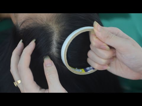 ASMR Scalp Massage Sounds, Scalp Scratch On Real Person, Therapy Sounds For rReduce Headache
