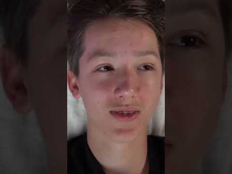 Facial Serums: Hydration, Pimples & Scarring Explained #shorts