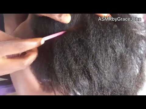 Asmr Dandruff Cleaning | #flakes #asmr #dryscalp