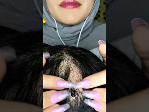 Bugs&Lice Plucking 💆🏻‍♀️🐜 #asmr #satisfying #visualtingle #asmrmassage #canada #shorts #relax