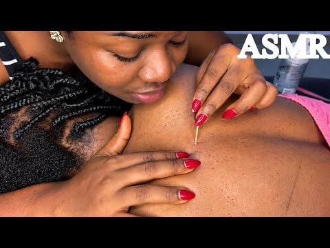ASMR✨ Back Pimples Nitpicking, Shaving, Oiling and Massage Plus Scalp Loosening 