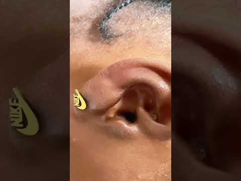 Asmr deep ear cleaning #asmr #earcleaning