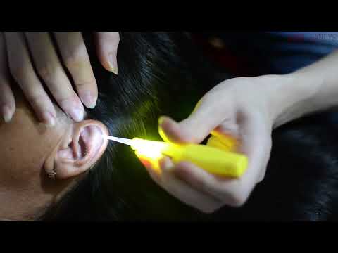 ASMR Scalp Scratching, Scalp Massage, Nape Attentive For Sleep ( No Talking )