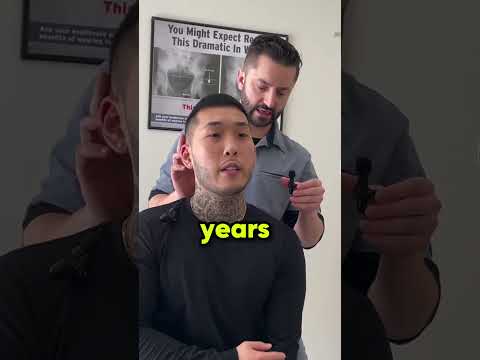 Nerve Damage Causing Shooting Tingling & Numbness | Trending Videos #shorts #asmr #neckpain #tiktok