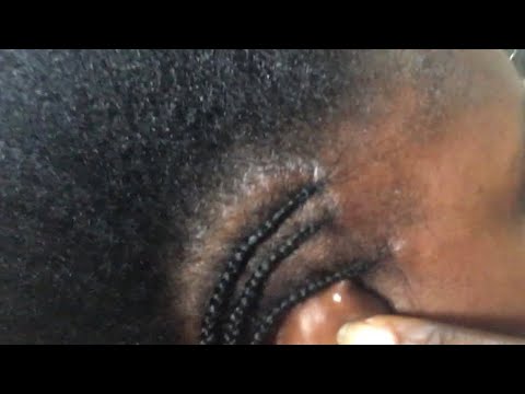 Asmr | oiling and scratching #hairoil #hairmassage