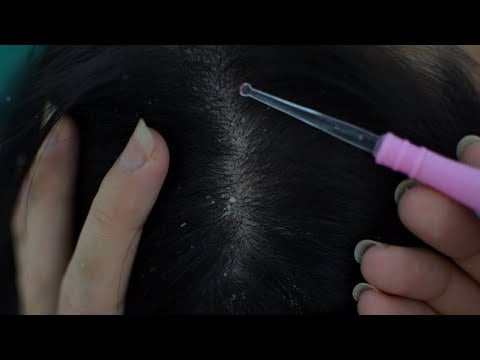 ASMR Scalp Check And Treatment Relaxing For Deep Sleep / Asmr Medical Roleplay / No Talking