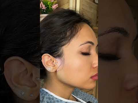 Asmr ear 👂 exam #asmr #relax #relaxing #asmrsounds #asmrvideo #tingles #medical #satisfying #sleep