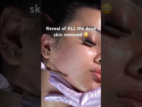 ASMR Dermaplaning - Part 2