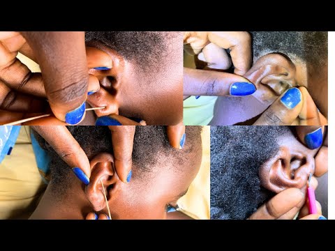 Asmr✨ |Attentive Deep Ear Cleaning For Sleep