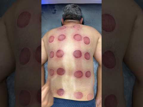 pizza cupping😍🍕#shorts #shortsvideo #youtubeshorts #explore #cupping #pizza