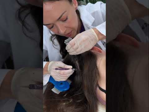 Asmr scalp tingles #asmr #asmrsounds #asmrvideo #relax #relaxing #satisfying #hair #sleep #tingles