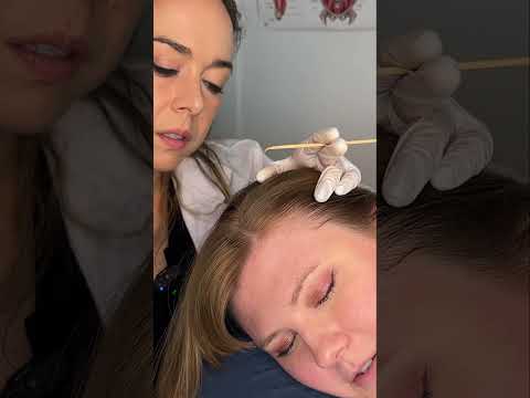 Asmr scalp 💆🏻‍♀️ #asmr #asmrsounds #asmrvideo #relax #relaxing #satisfying #hair #relax