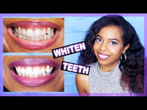 How To WHITEN Your TEETH At Home!! ♥