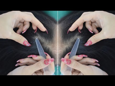 ASMR Hair Treatment, Hair Parting On Real Person Make You Fall Asleep ( No Talking )