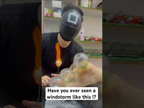 😍❤️‍🔥#short #shorts #explore #squidgame #fyp #youtubeshorts #cupping #asmr #massage #india #good