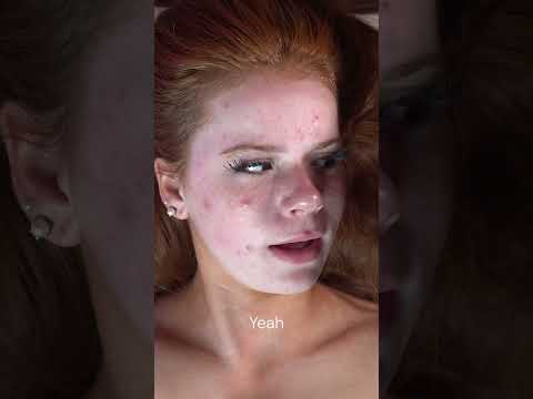 Shocking Deep Clean: Unbelievable Makeup & Skin Residue Removed! #shorts