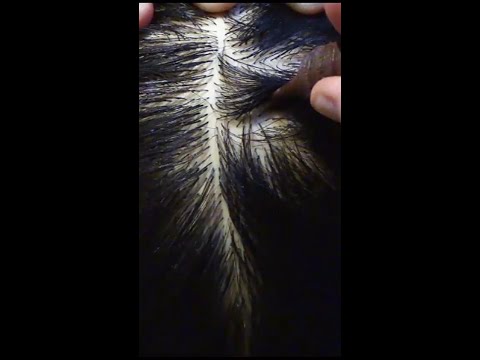 ASMR Tingly Scalp Check #shorts