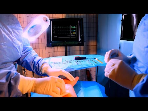 ASMR Hospital Orthopedic Surgery on Your Arm | Medical Role Play